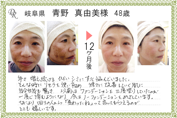 ドクターリセラ症例写真