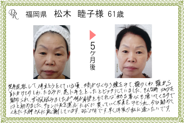 ドクターリセラ症例写真