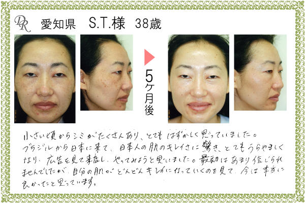 ドクターリセラ症例写真